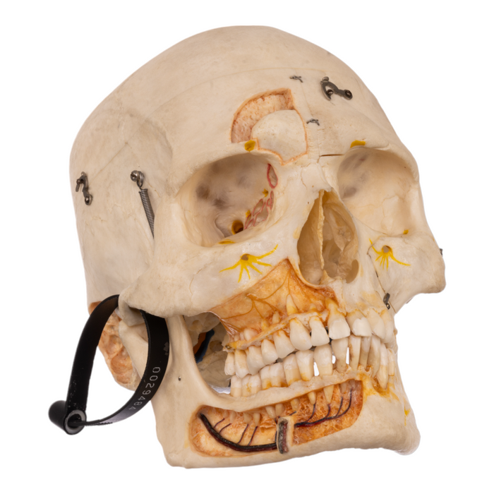 Real Human Skull with Carrying Case  - Dissected