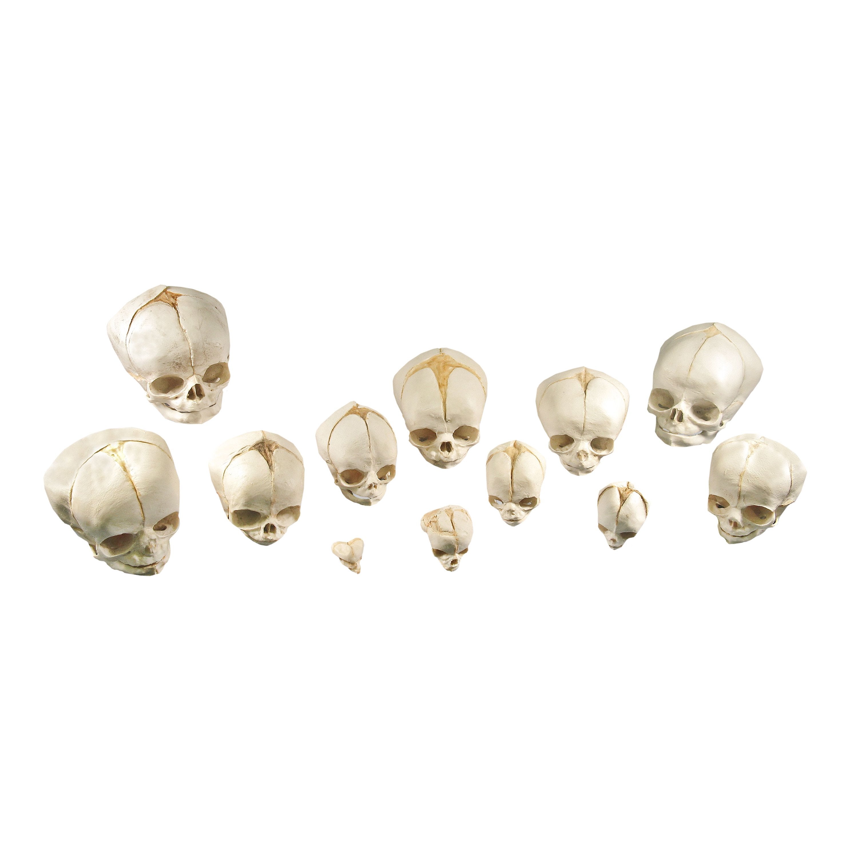 Real Human Fetal Skeleton On Stand — Skulls Unlimited International, Inc.