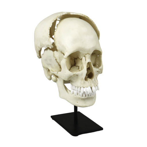 Replica Human Medical Study Skull - Articulated