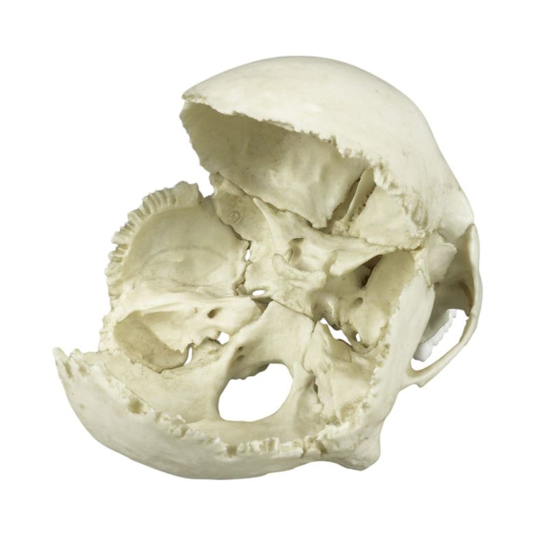 Replica Human Medical Study Skull - Articulated