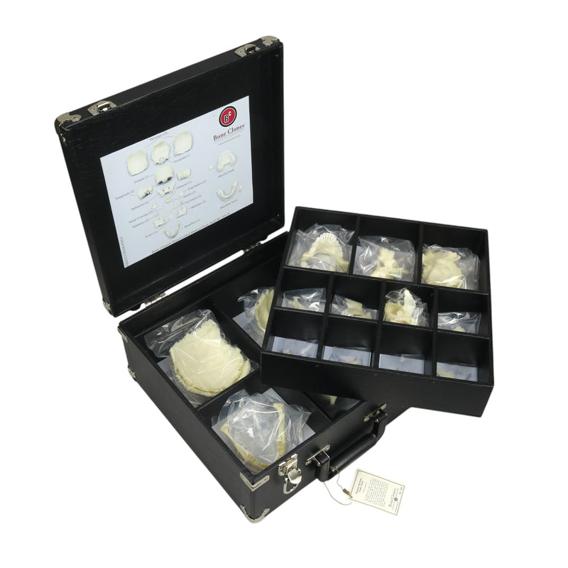 Repilca Human Medical Study Skull - Disarticulated