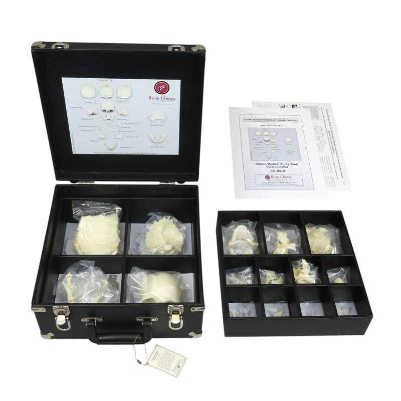 Repilca Human Medical Study Skull - Disarticulated