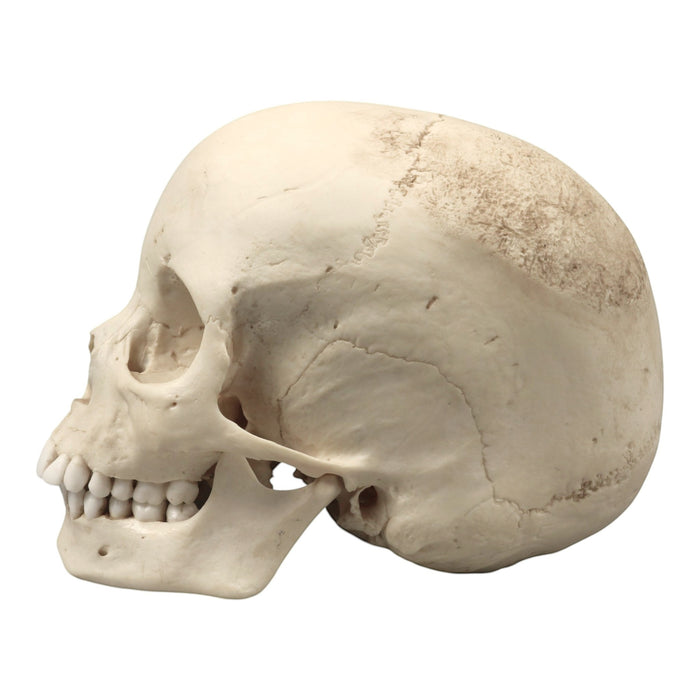 Replica Human Skull - Porotic Hyperostosis and Cribra Orbitalia