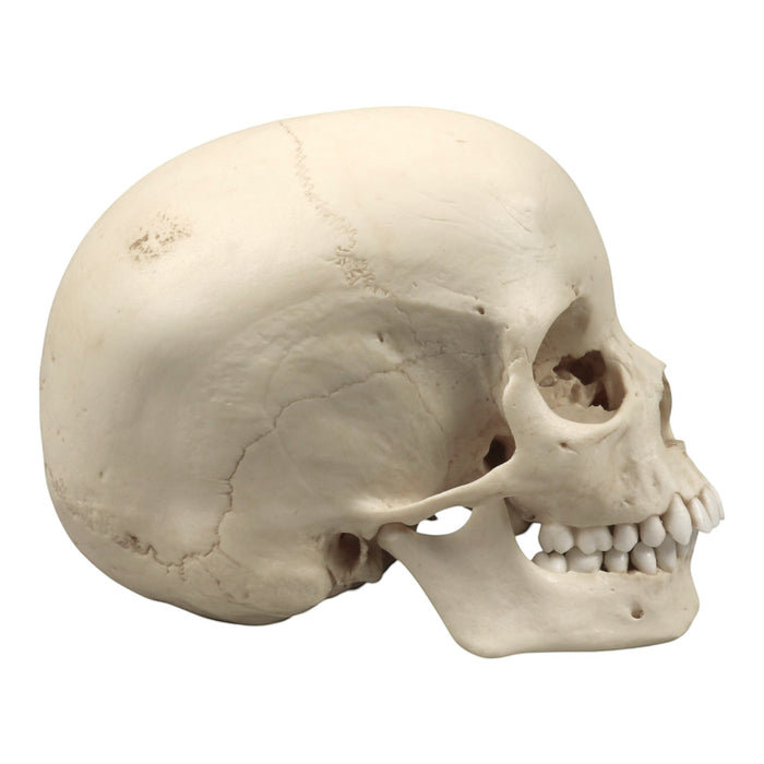 Replica Human Skull - Porotic Hyperostosis and Cribra Orbitalia