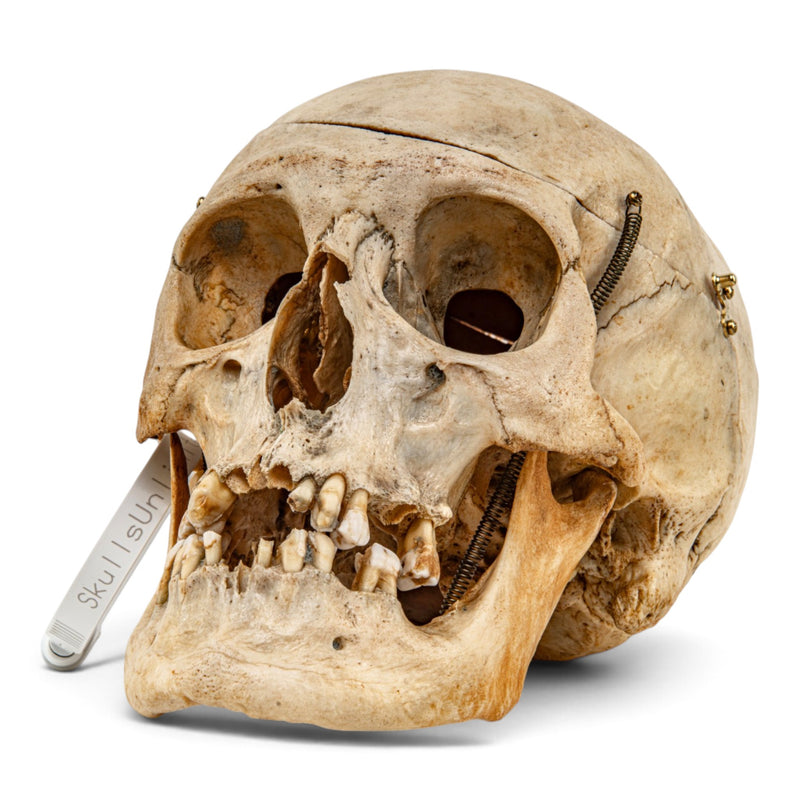 Real Human Skull