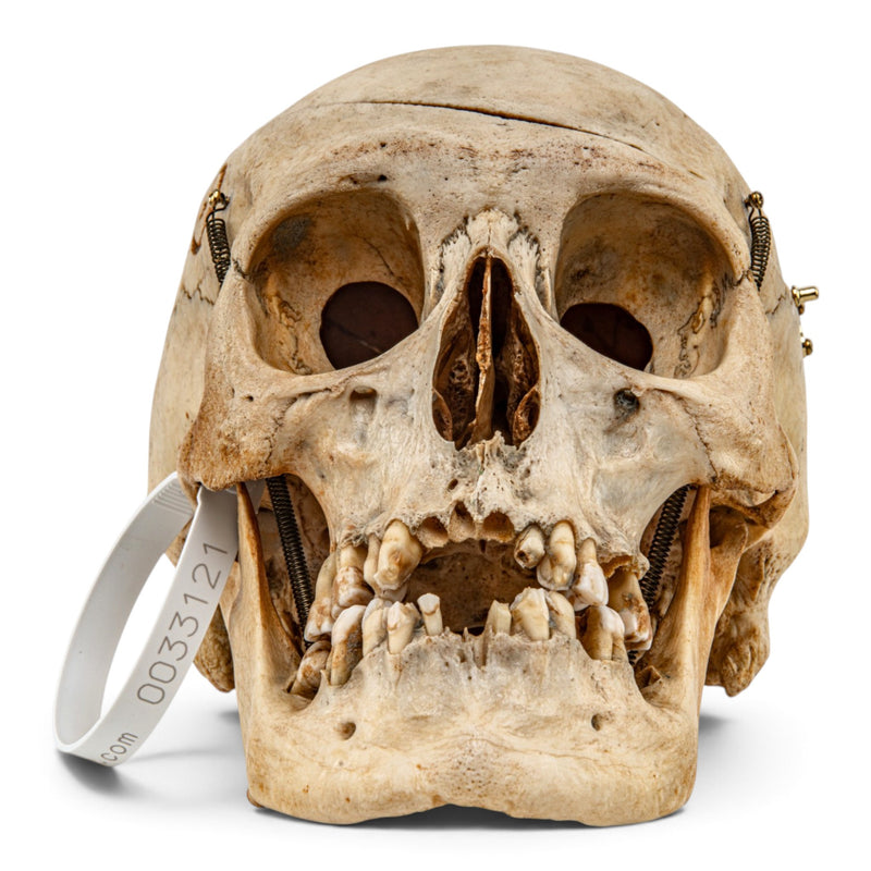 Real Human Skull