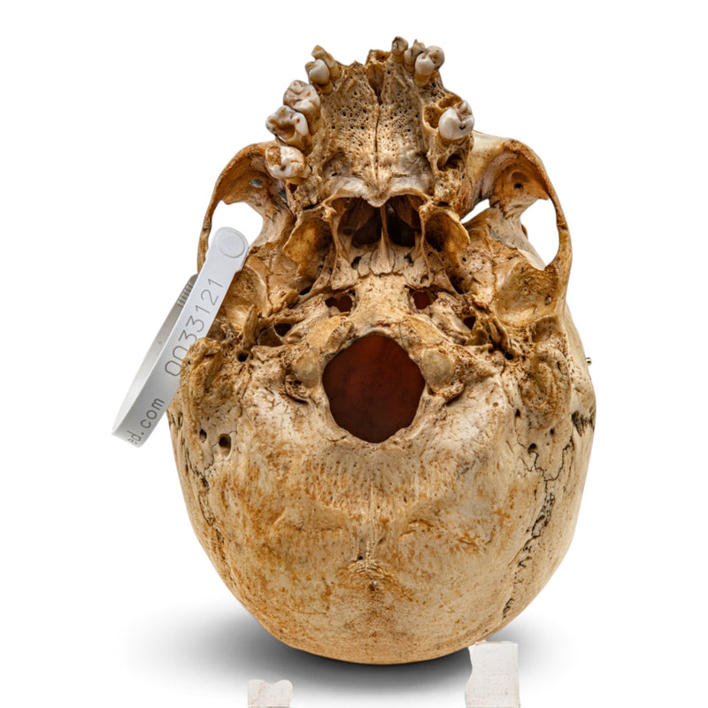 Real Human Skull
