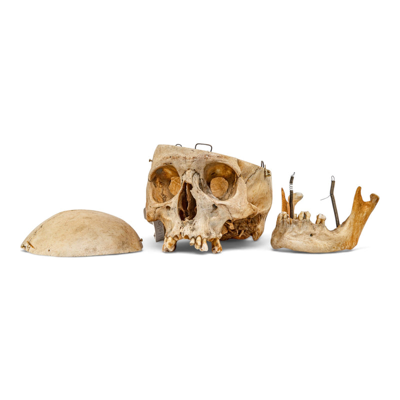 Real Human Skull