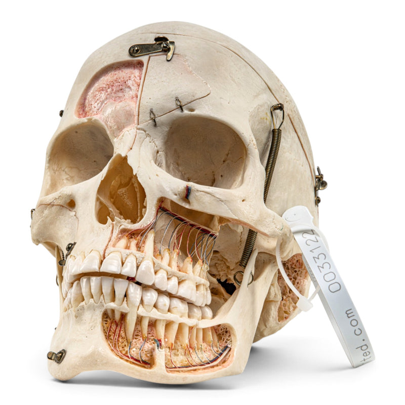 Real Human Skull - Dissected with Carrying Case