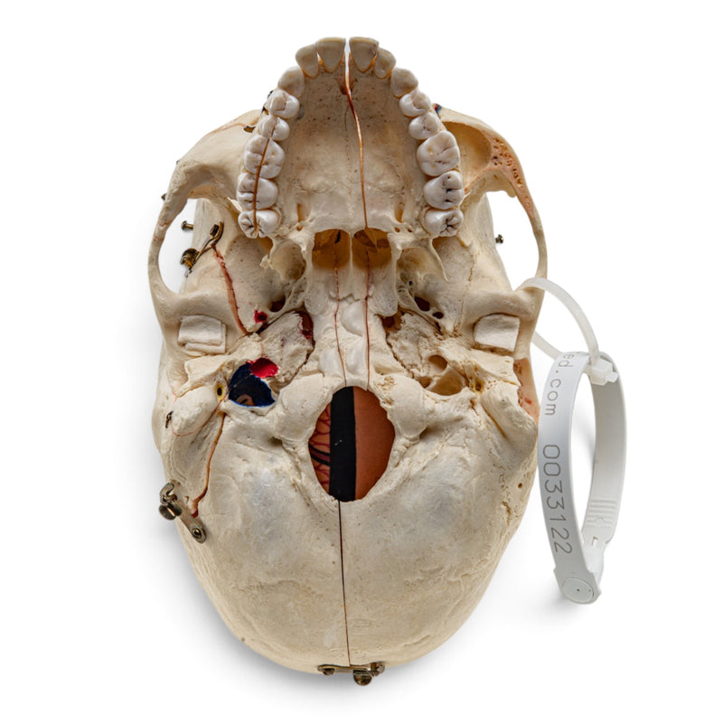Real Human Skull - Dissected with Carrying Case