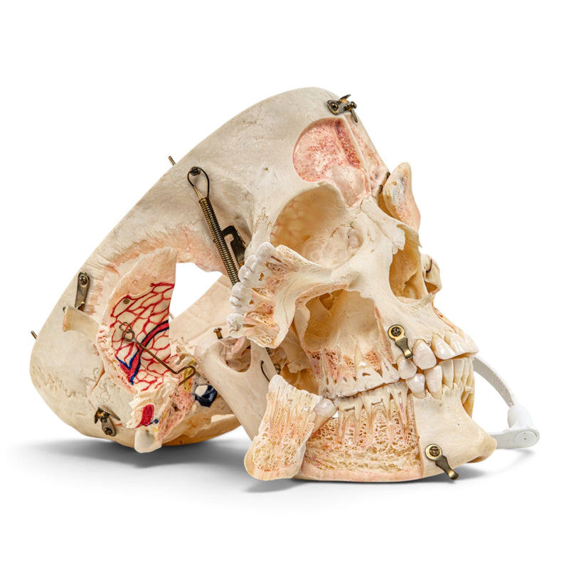 Real Human Skull - Dissected with Carrying Case