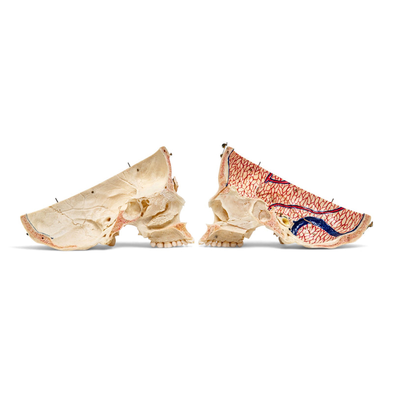 Real Human Skull - Dissected with Carrying Case