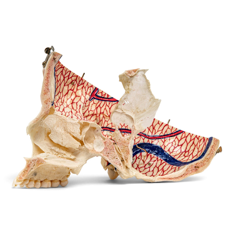 Real Human Skull - Dissected with Carrying Case
