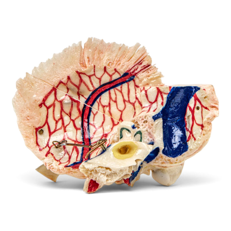 Real Human Skull - Dissected with Carrying Case