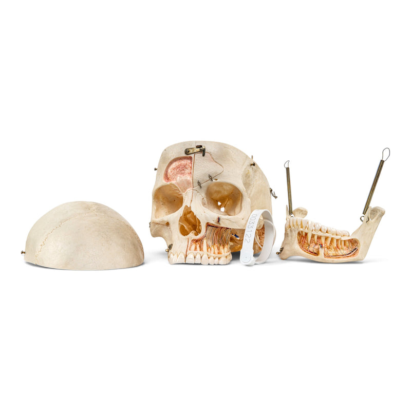 Real Human Skull - Dissected with Carrying Case
