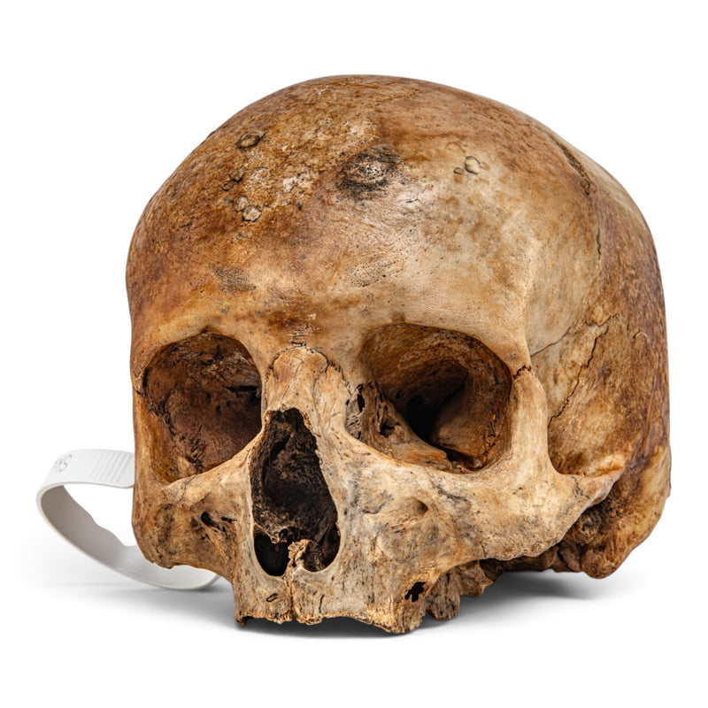 Real Human Skull - No Mandible