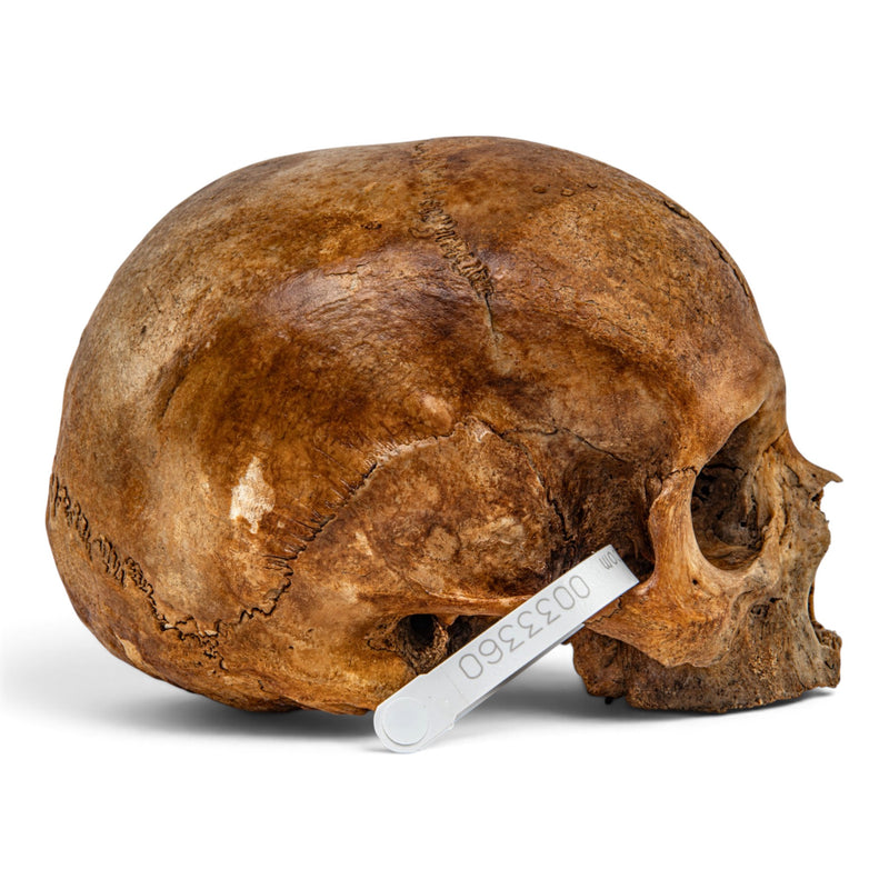 Real Human Skull - No Mandible