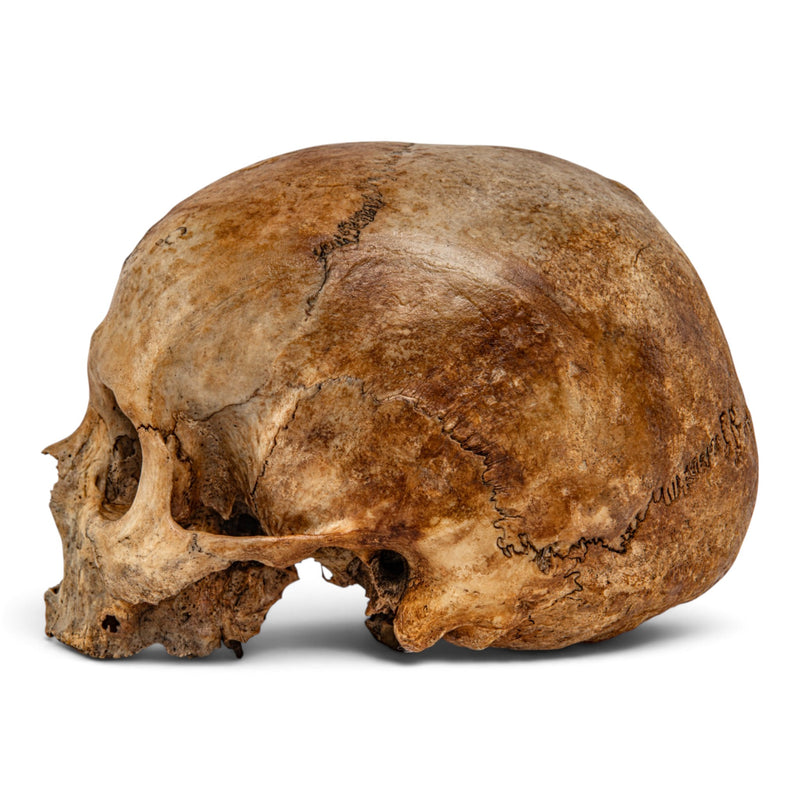 Real Human Skull - No Mandible