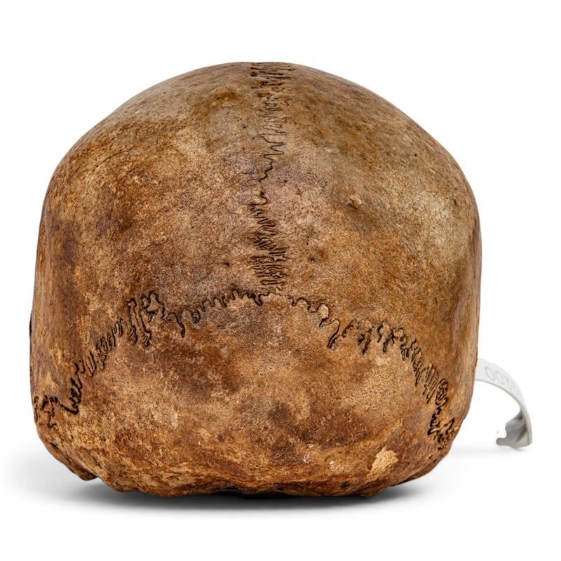 Real Human Skull - No Mandible