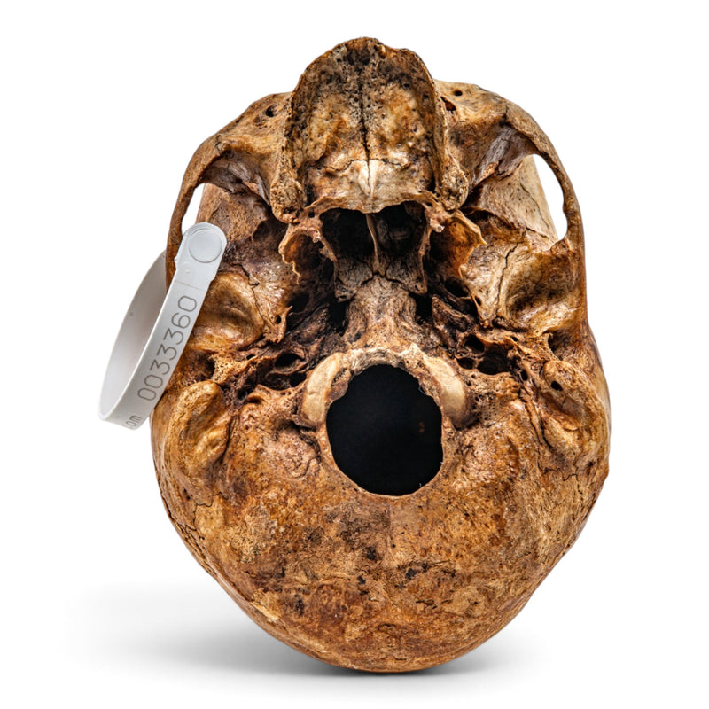 Real Human Skull - No Mandible
