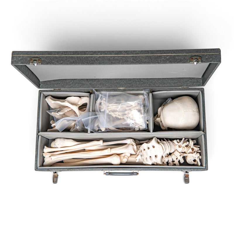 Real Human Skeleton - Disarticulated - Composite with Carrying Case