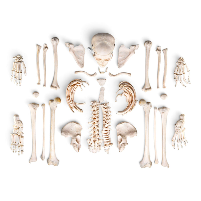 Real Human Skeleton - Disarticulated - Composite with Carrying Case