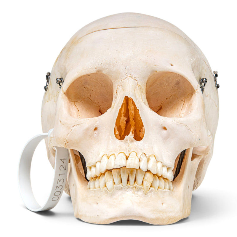 Real Human Skeleton - Disarticulated - Composite with Carrying Case
