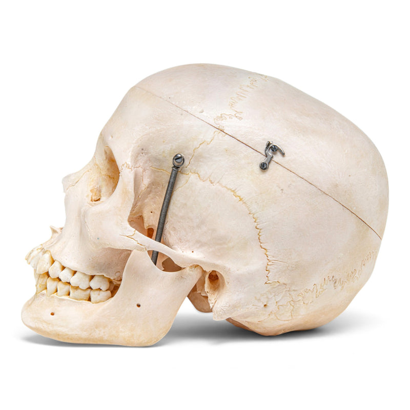 Real Human Skeleton - Disarticulated - Composite with Carrying Case