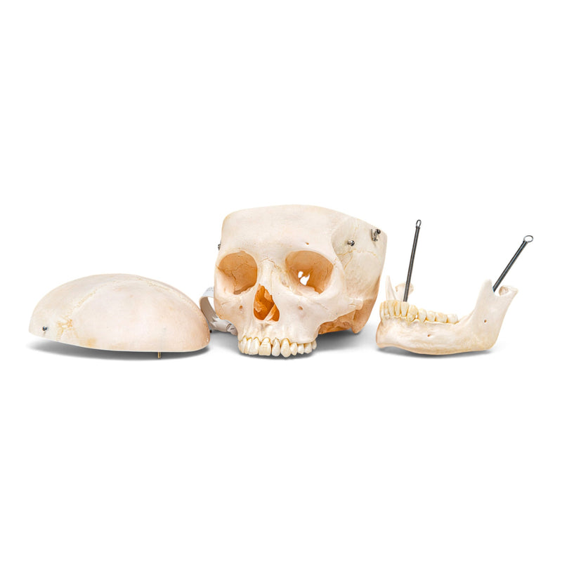 Real Human Skeleton - Disarticulated - Composite with Carrying Case