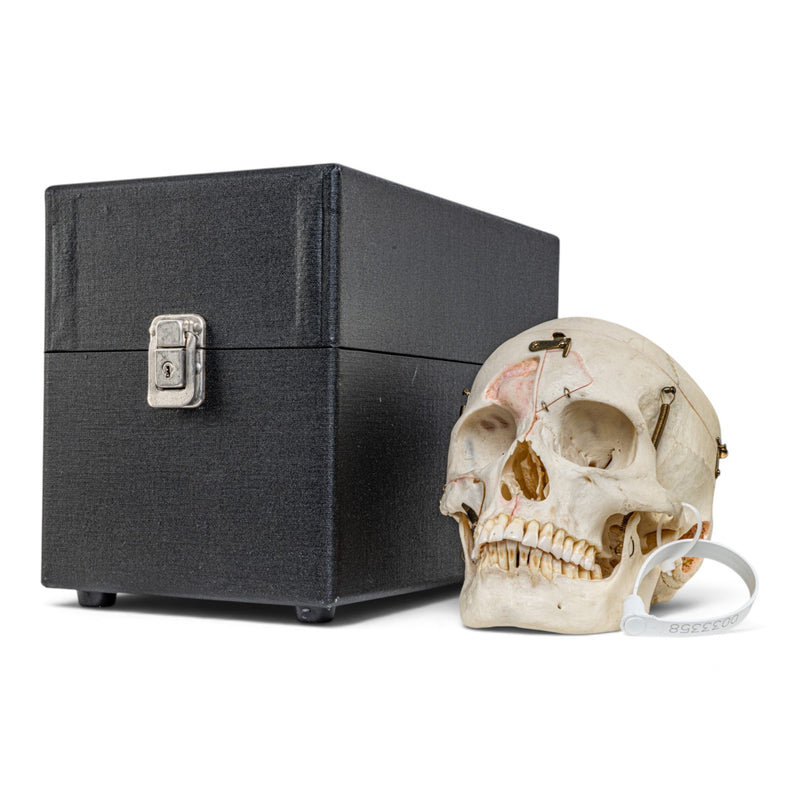 Real Human Skull - Dissected - with Carrying Case