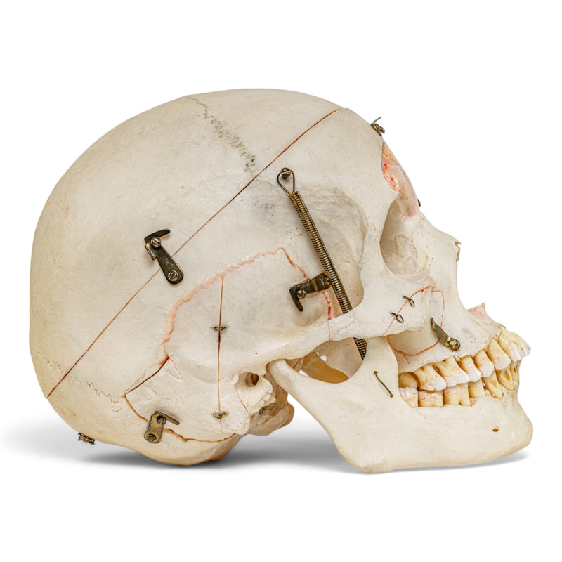 Real Human Skull - Dissected - with Carrying Case
