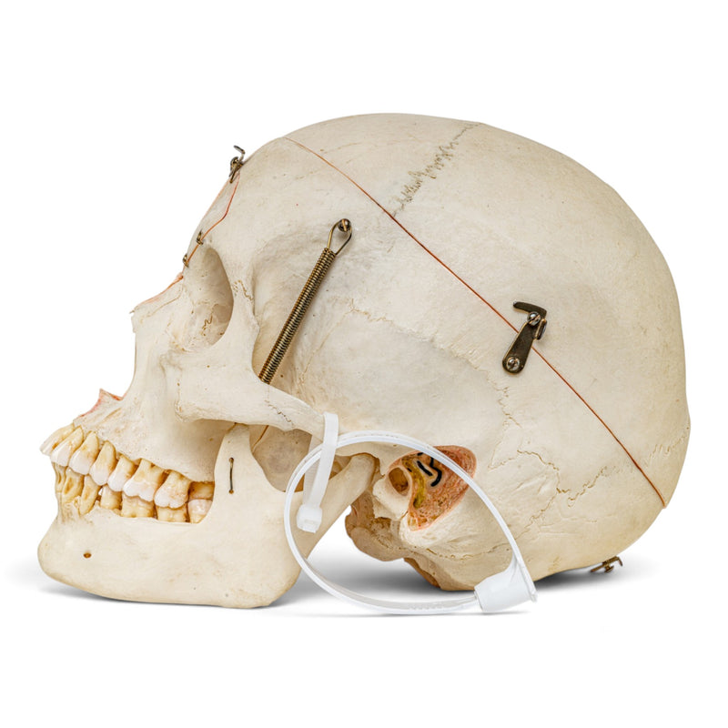 Real Human Skull - Dissected - with Carrying Case
