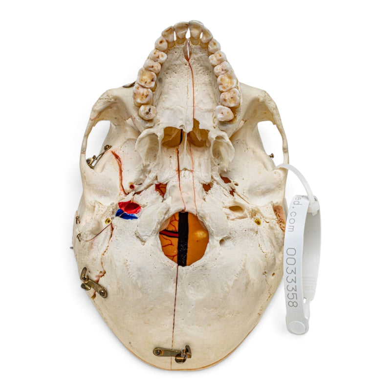 Real Human Skull - Dissected - with Carrying Case