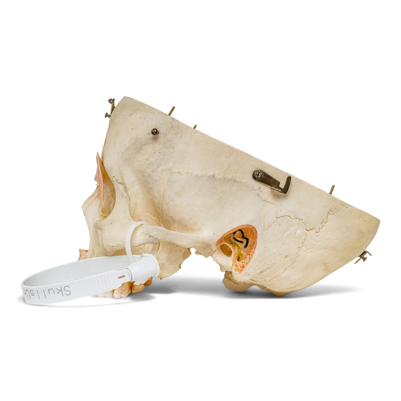 Real Human Skull - Dissected - with Carrying Case