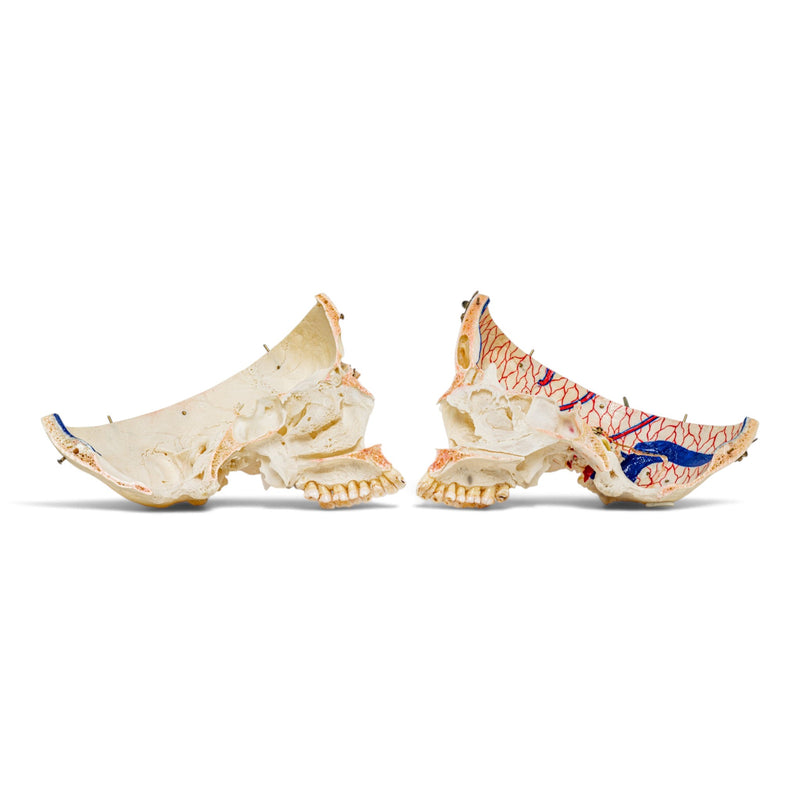 Real Human Skull - Dissected - with Carrying Case