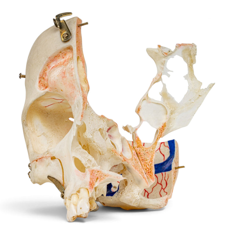 Real Human Skull - Dissected - with Carrying Case
