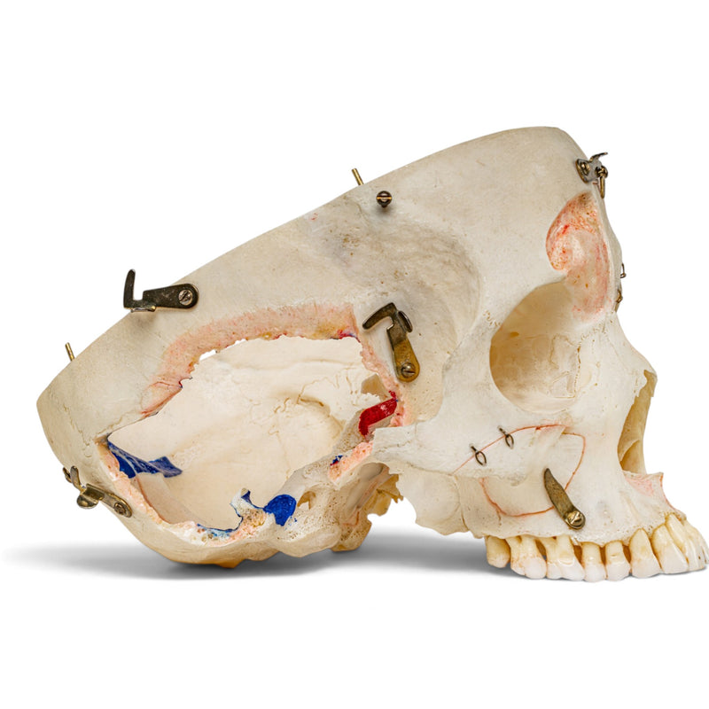 Real Human Skull - Dissected - with Carrying Case