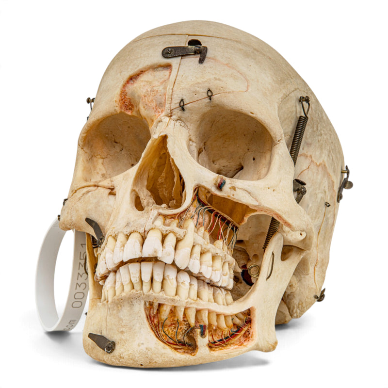 Real Human Skull - Dissected