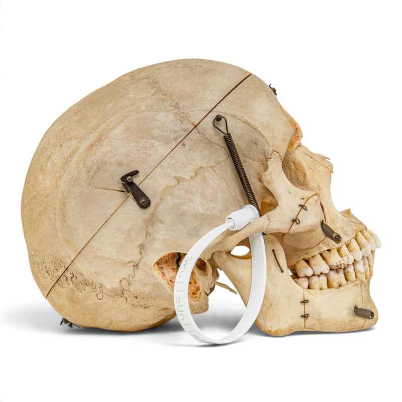 Real Human Skull - Dissected