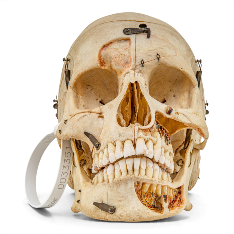 Real Human Skull - Dissected