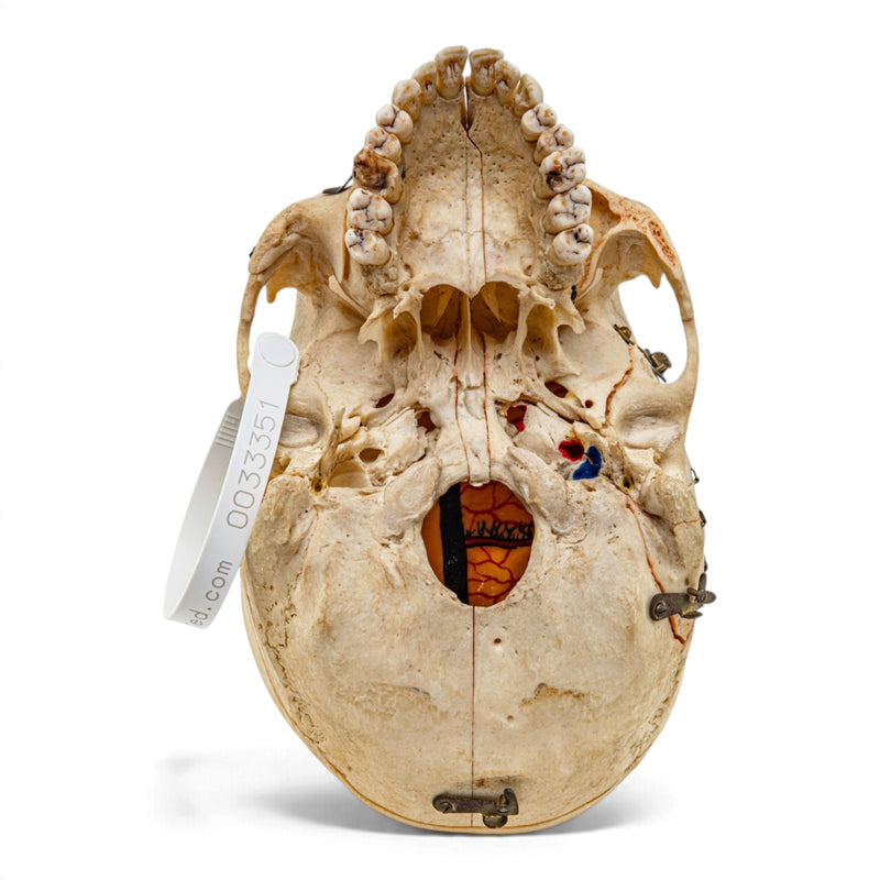 Real Human Skull - Dissected