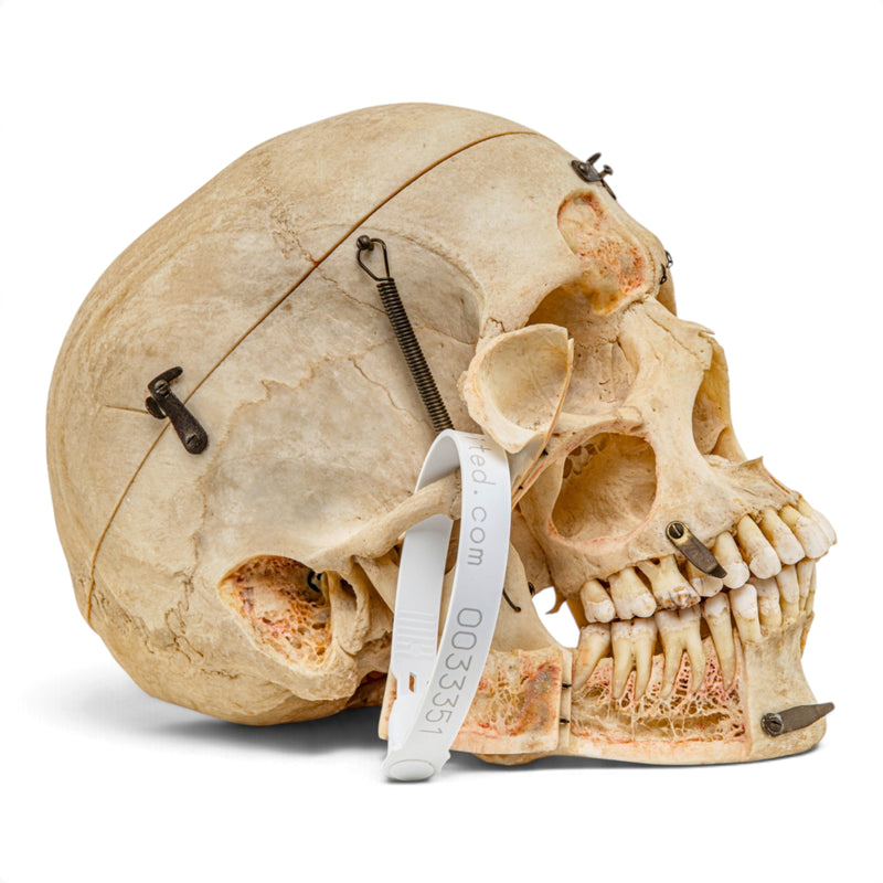Real Human Skull - Dissected