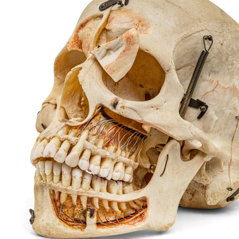 Real Human Skull - Dissected
