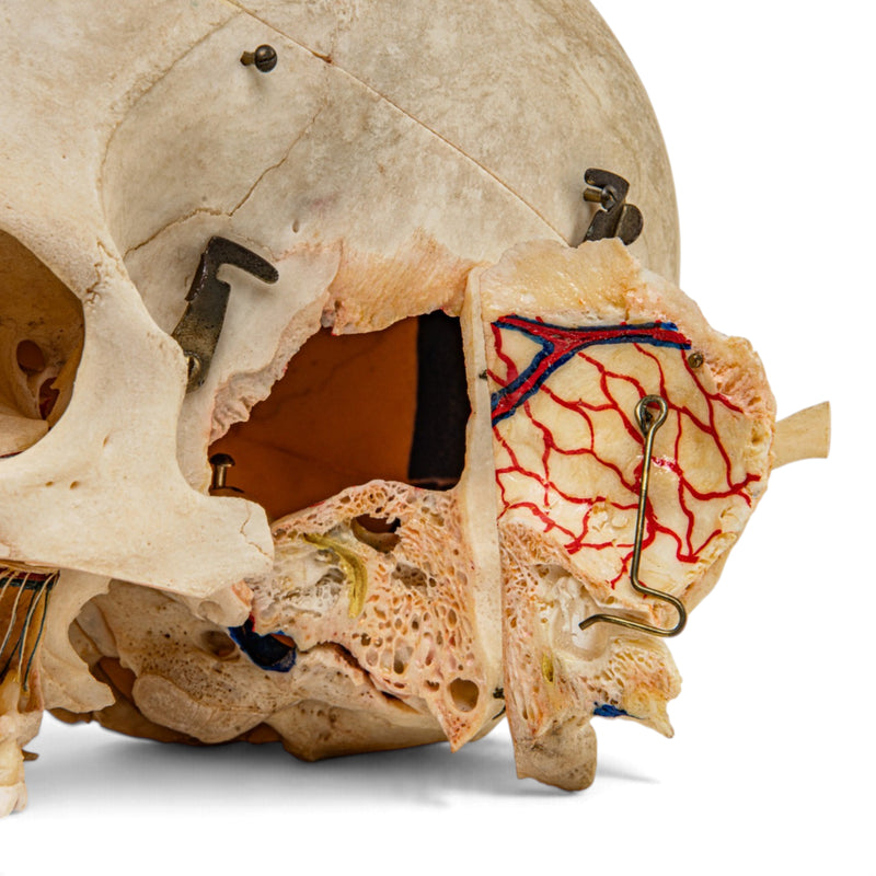 Real Human Skull - Dissected