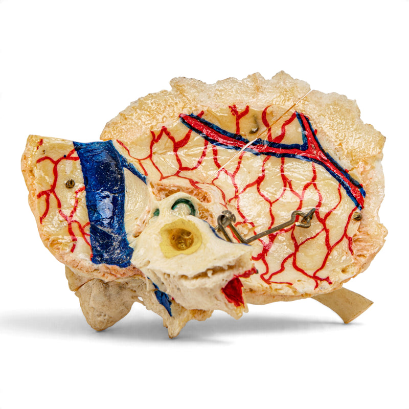 Real Human Skull - Dissected