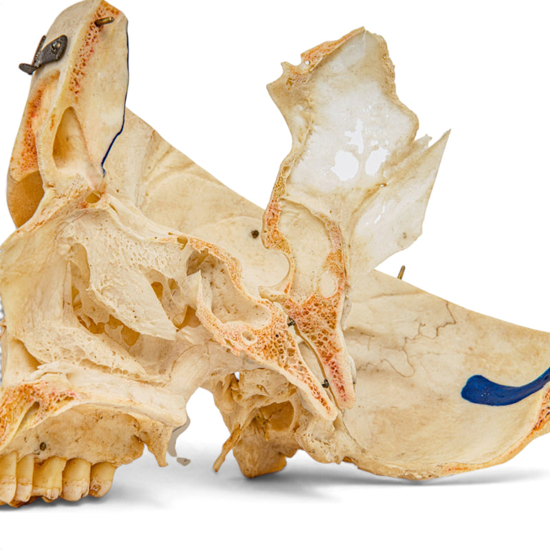 Real Human Skull - Dissected