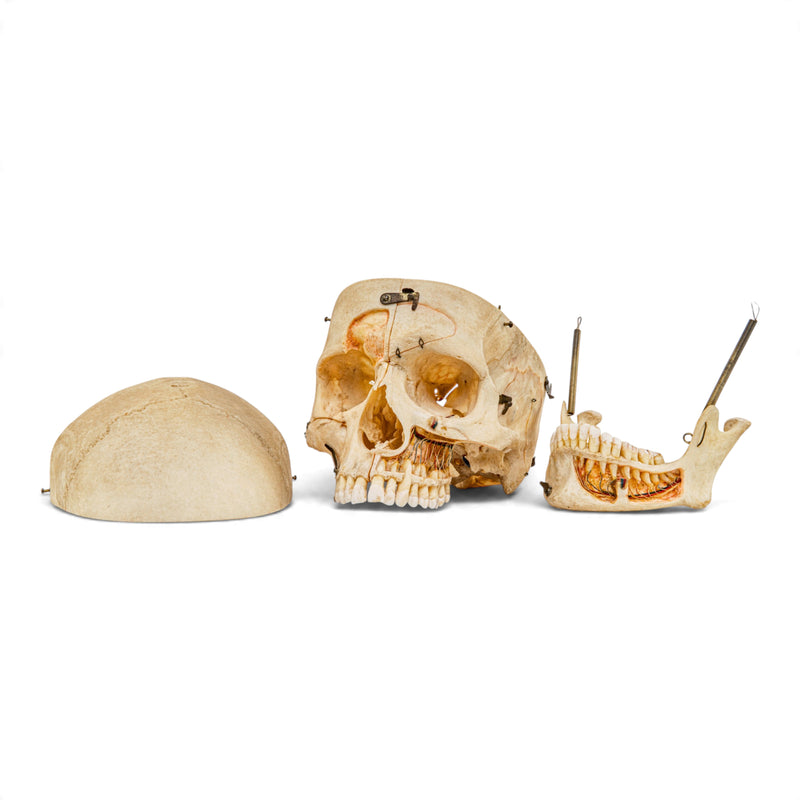 Real Human Skull - Dissected