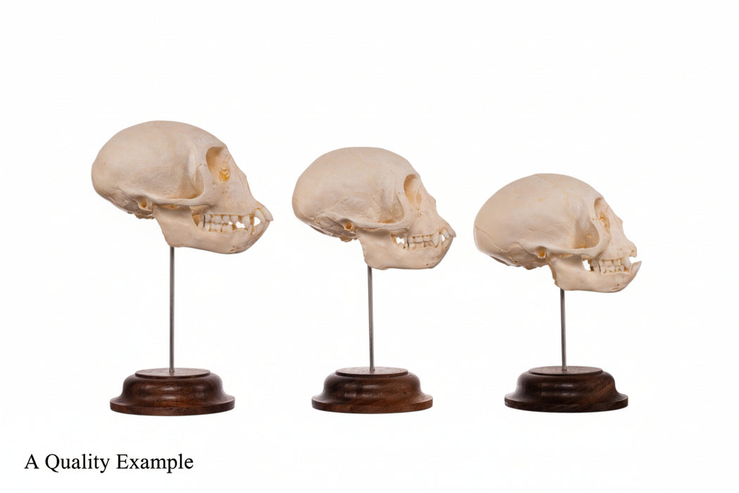Three human skull models on stands against a white background