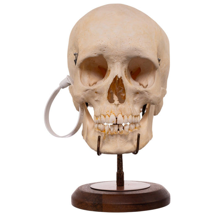 Human Skull Display Stand