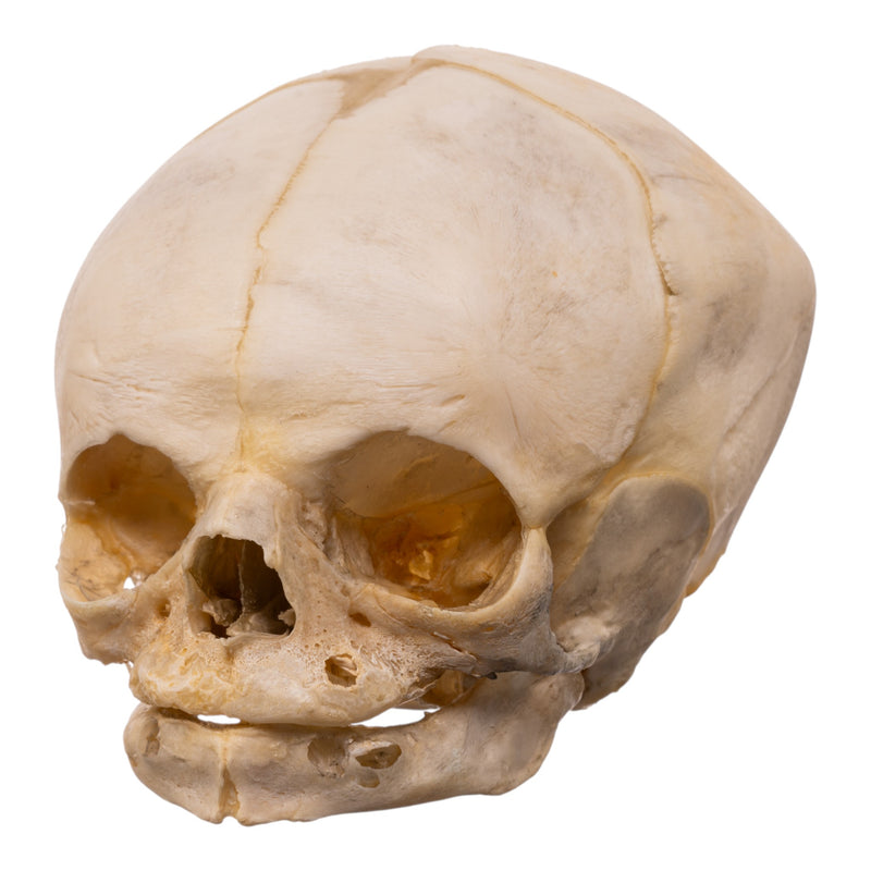 Real Human Fetal Skull